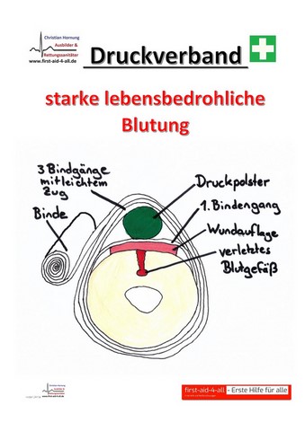 Druckverband